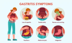Common Digestive Issues