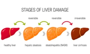 Effects of liver disease
