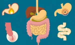 Common Digestive Problems