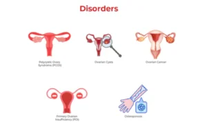 Common Disorders of the Female Reproductive System