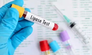 How Is It Diagnosed