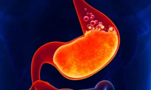 What Are Digestive Enzymes