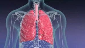 Location of the lungs