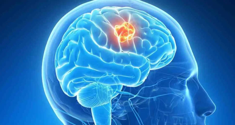 Brain Disorders and Diseases