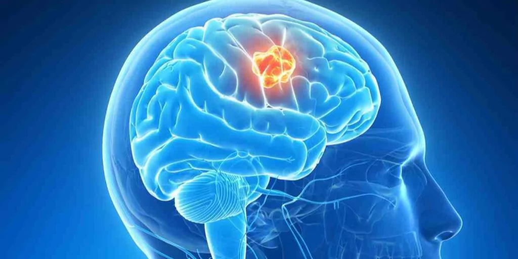 Brain Disorders and Diseases