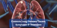 Anatomy of the Lungs Bronchi, Alveoli & Airways