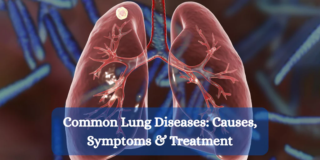 Common Lung Diseases: Causes, Symptoms & Treatment