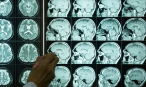 Diagnosis of Brain Diseases