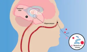 Infectious Brain Diseases