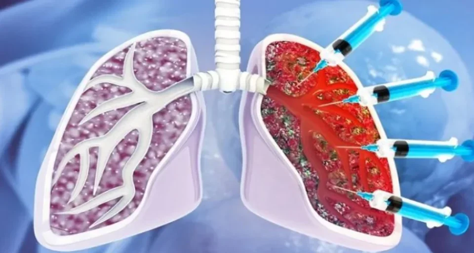 Medical Innovations in Treating Lung Diseases