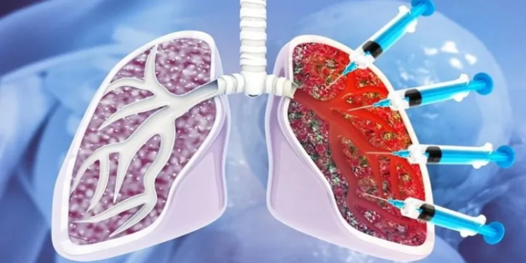 Medical Innovations in Treating Lung Diseases