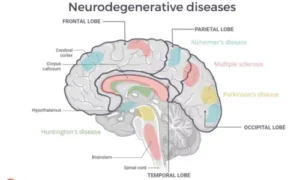 Neurodegenerative Diseases