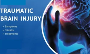 Traumatic Brain Injuries