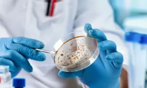 Prevention and Control of Microbial Diseases